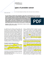 Unusual subtypes of prostate cancer