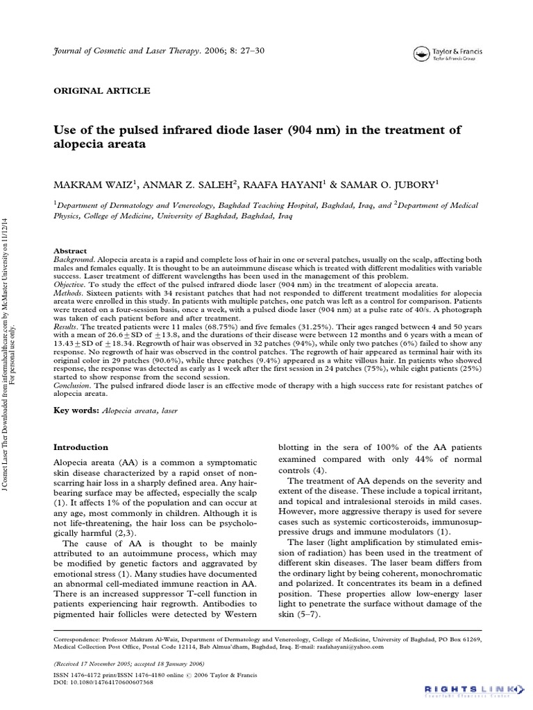 Alopecia Areata Pulsed Infrared Diode Laser PDF Immune System Laser