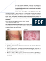 Caso 13 Herpes Zoster Z