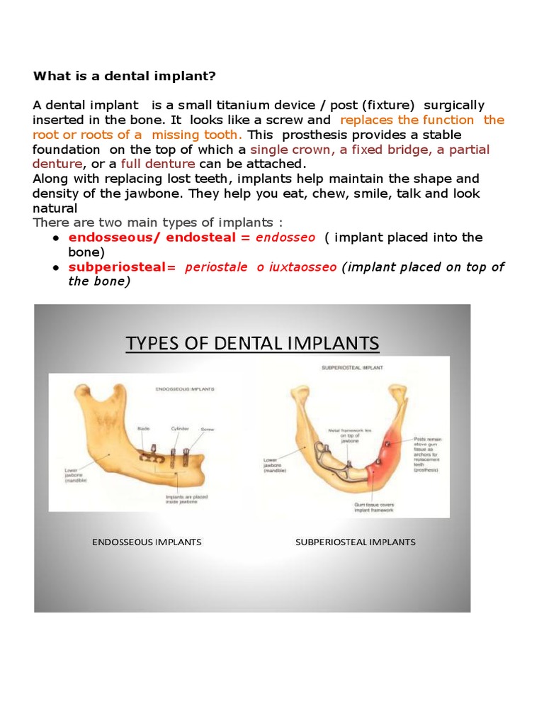 Dental Implants | PDF | Dental Implant | Medicine