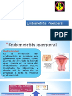 Endometritis Puerperal