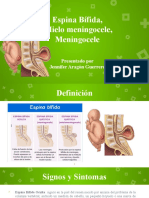 Espina Bifida - Holoprosencefalia