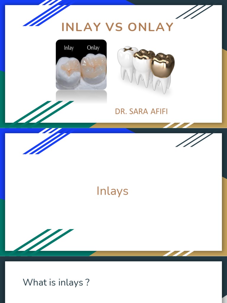 Inlay Vs Onlay: Dr. Sara Afifi | PDF | Dentistry Branches | Health Sciences