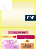 ADENOMIOSIS