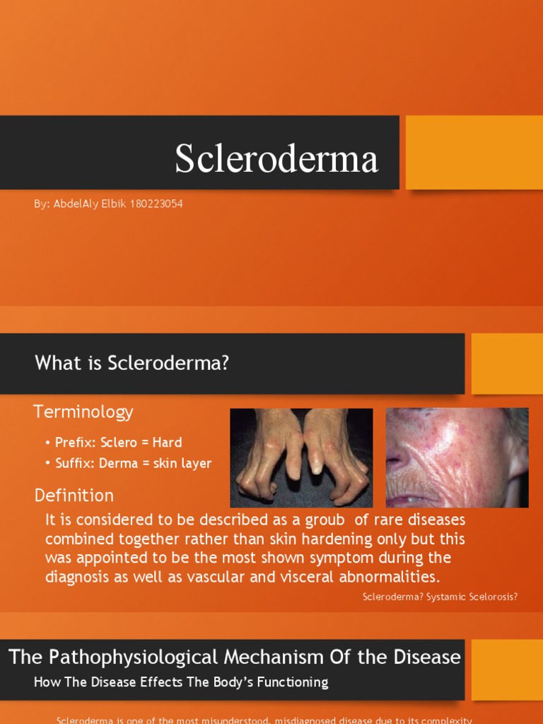 Scleroderma Etiology Synonym