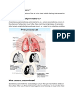 What is a Pneumothorax