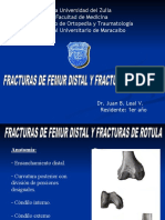 Femur Distal y Rotula