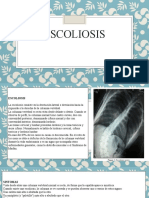 Escoliosis Diapositivas