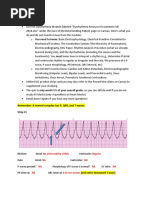 ECG Quiz Review and Practice Strip Answers