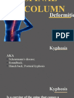 KYPHOSIS