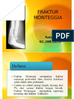 Dokumen - Tips Fraktur-Monteggia