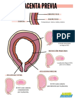 Placenta Previa