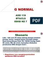 Ekg Normal: AGD 118 Bt&Cls Edisi Ke 7