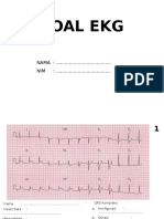 Soal Ekg 3 PDF Free