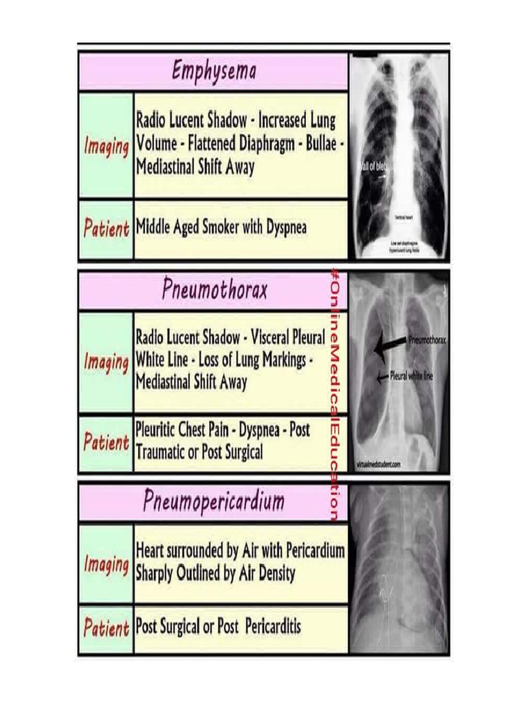 Radiology X RAYS | PDF