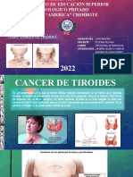 Cancer de Tiroides Grupal