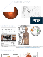 Neuritis Optica