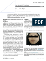 Oral Rhabdomyosarcoma A Case Report 2161 0681 3 161