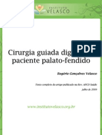 Cirurgia Guiada Digital Em Paciente Palato - Fendido