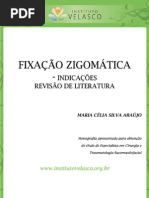 FIXAÇÃO ZIGOMÁTICA INDICAÇÕES REVISÃO DE LITERATURA