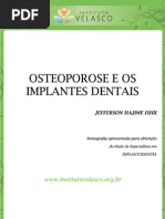 Osteoporose e Os Implantes Dentais