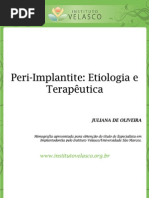 PERI-IMPLANTITE ETIOLOGIA E TERAPÊUTICA