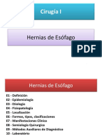 Hernias de Esófago - Hiatal