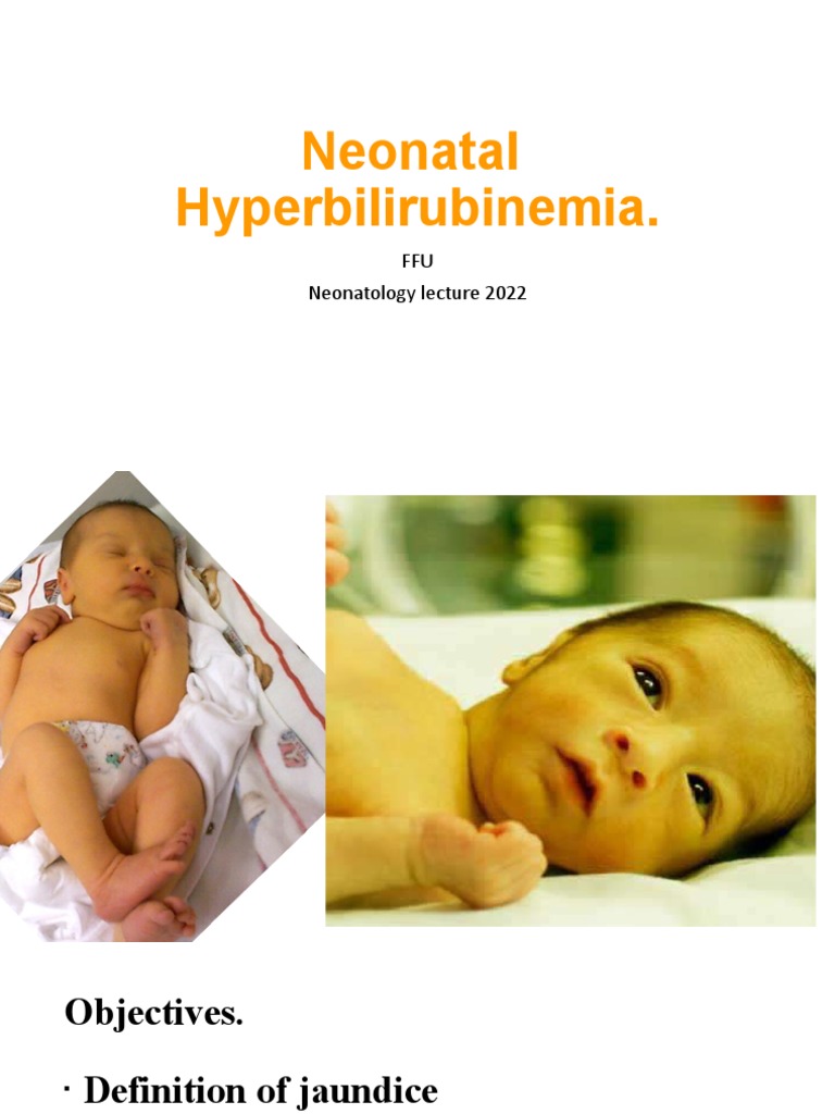 Neonatal Jaundice PDF Breastfeeding Breast Milk
