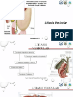 Litiasis Vesicular en Pediatria Corregido