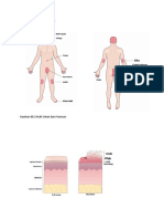 Gambar 60.1 Lokasi Psoriasis