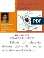 Manual Placenta Removal Procedure