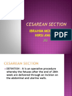 c-section-180515193200