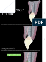 Optimal Emergence Profiles for Implant Restorations