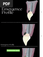 ITI Treatment Guide, Volume 10 (17mb) | PDF | Dental Implant