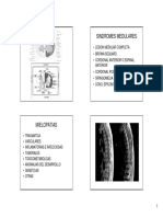 Sindromes Medulares