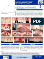 A new porcine-derived collagen matrix to thicken peri-implant soft tissues in high aestethic value areas