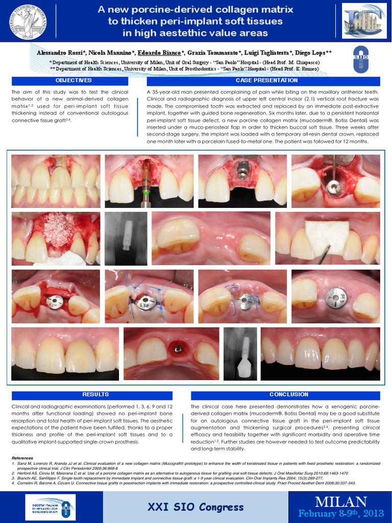 A New PorcineDerived Collagen Matrix To Thicken PeriImplant Soft