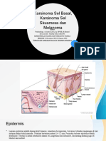 Referat BP KSS KSB MELANOMA