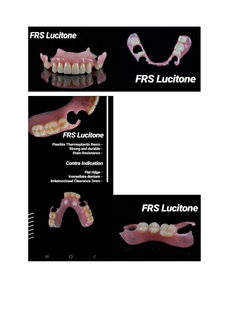 Gambar Jenis GT | PDF