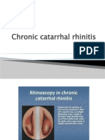 Chronic Catarrhal Rhinitis