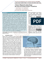 Brain Tumor Diagnosis Using Image de Noising With Scale Invariant Feature Transform