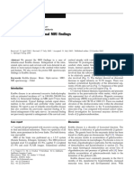 Krabbe Disease Unusual MRI Findings Source Pediatr Radiol SO 2006 Jan 36 1 61 4 (PMIDM16247616)