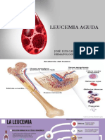 4 - Leucemia
