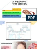 Acv Izquemico
