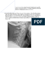 Difficult airway, case study 2018 อ.ประเสริฐ