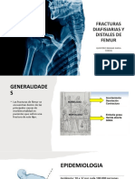 Fracturas de Femur