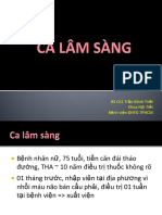 Ca Lam Sang - CME Than Kinh 21-01-2018