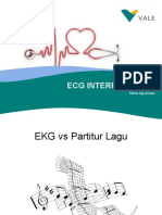EKG (Workshop SEN 2014)