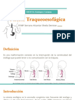 Fístula Traqueoesofagica