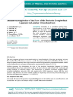 Radiation Diagnostics of The State of The Posterior Longitudinal Ligament in Lumbar Osteochondrosis